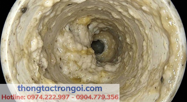 Cận cảnh lớp mỡ thừa và thức ăn đóng tảng dày đặc bên trong đường ống thoát nước gây tắc nghẽn và mùi hôi thối.